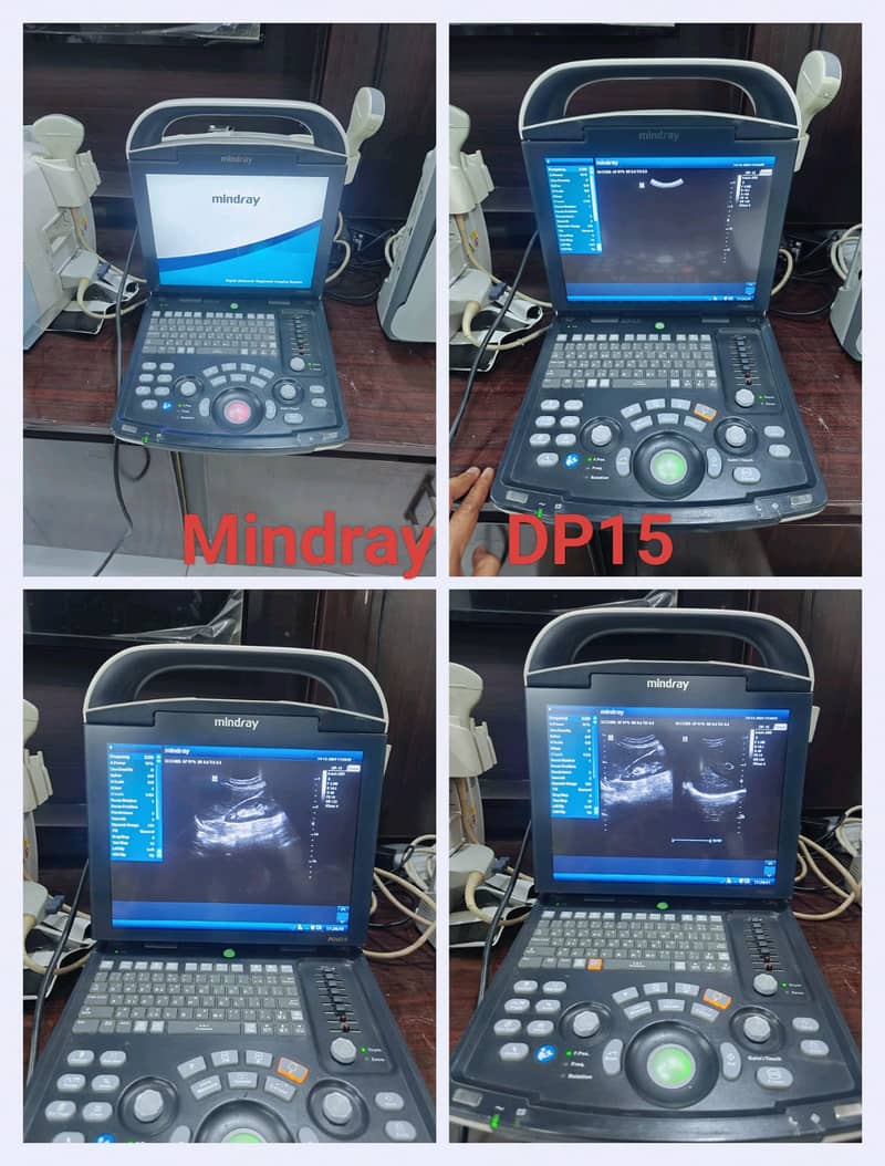 All types of Ultrasound Machines 1