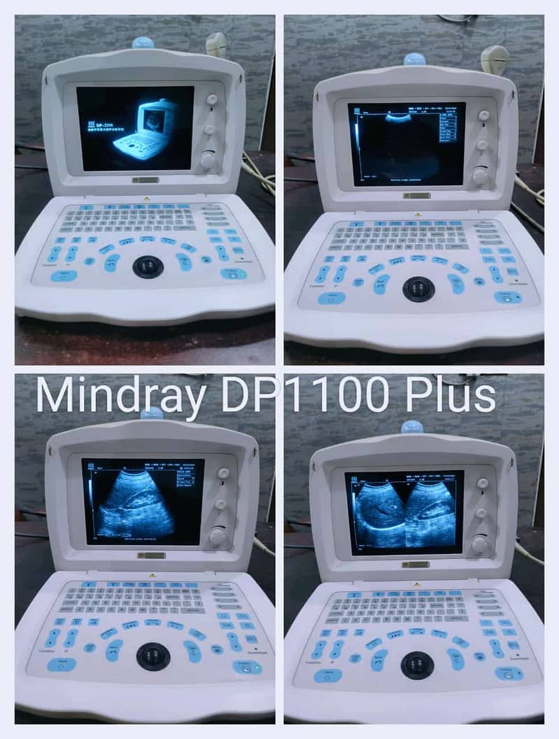 All types of Ultrasound Machines 3