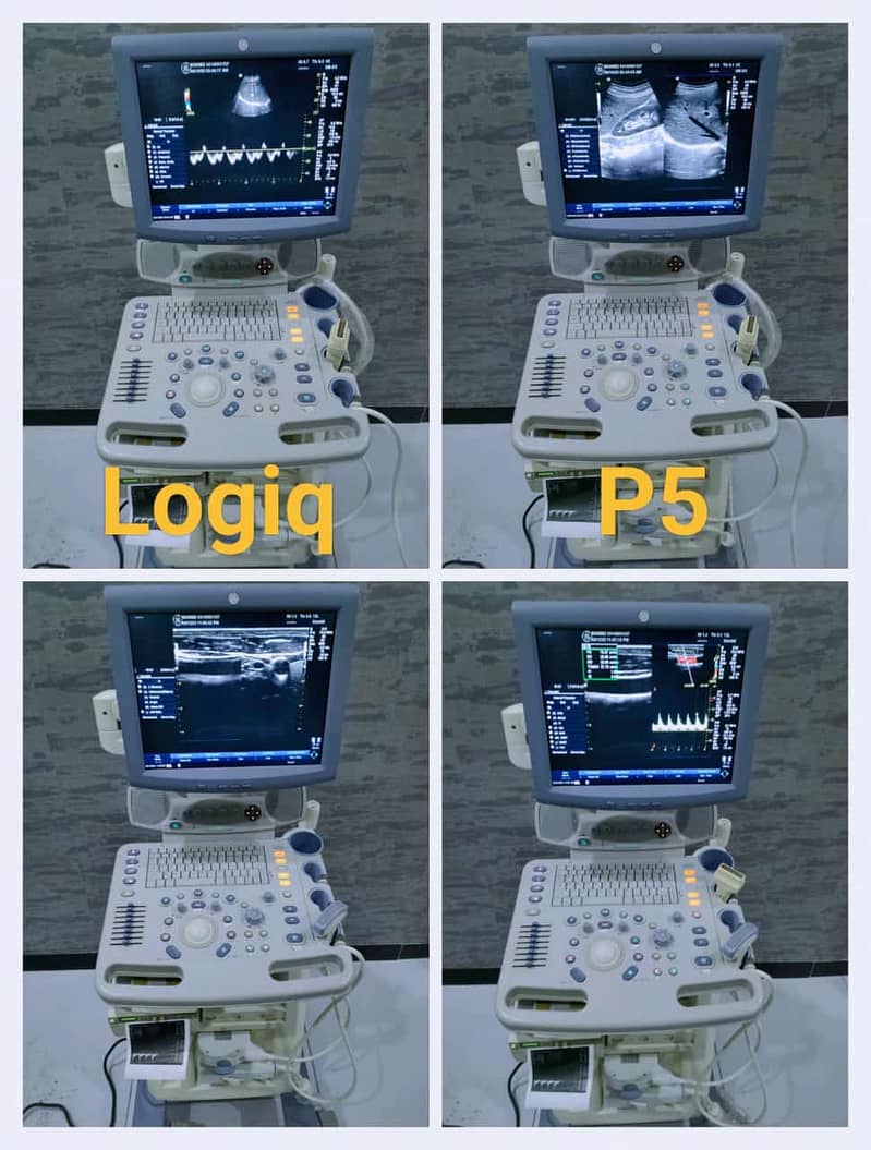 All types of Ultrasound Machines 6