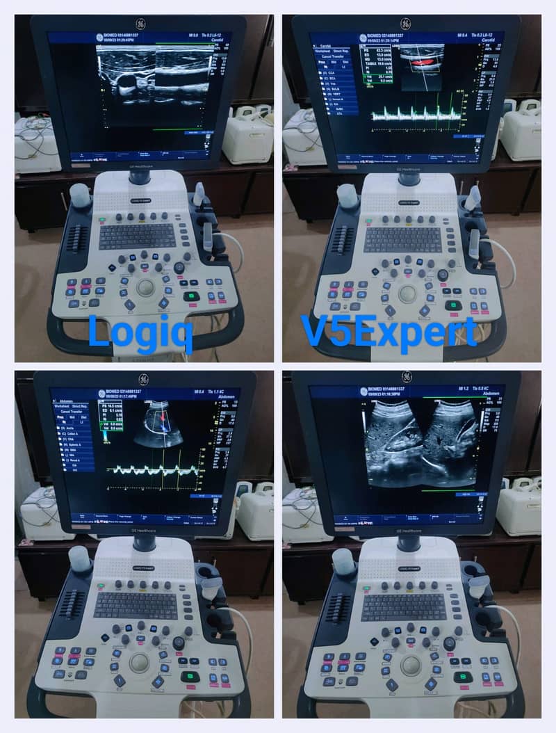 All types of Ultrasound Machines 9