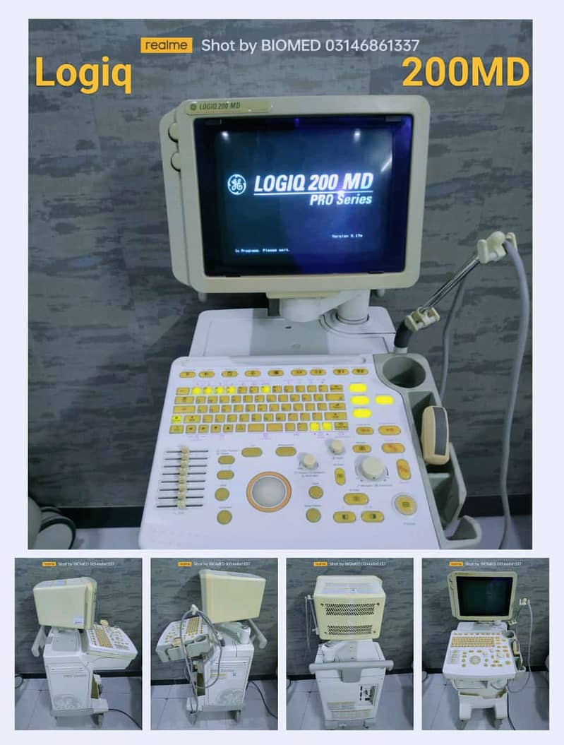 All types of Ultrasound Machines 11