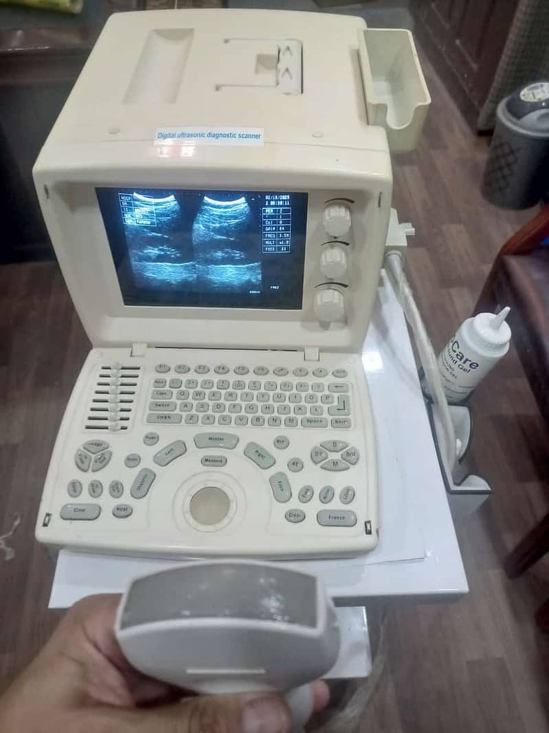 REFURBISHED Portable Chinese Ultrasound machine. 1