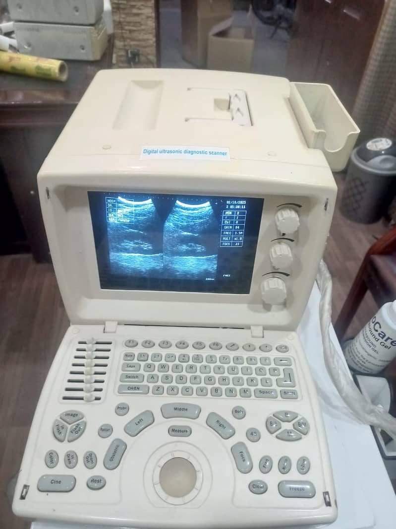 REFURBISHED Portable Chinese Ultrasound machine. 2