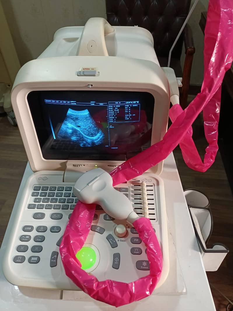 REFURBISHED Portable Chinese Ultrasound machine. 4