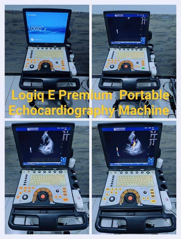 Ultrasound & Echocardiography Machines 2