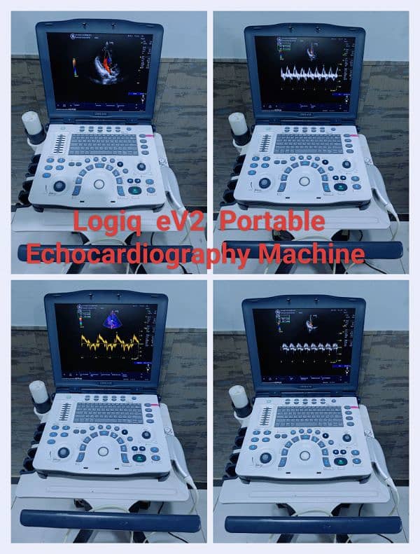 Ultrasound & Echocardiography Machines 3