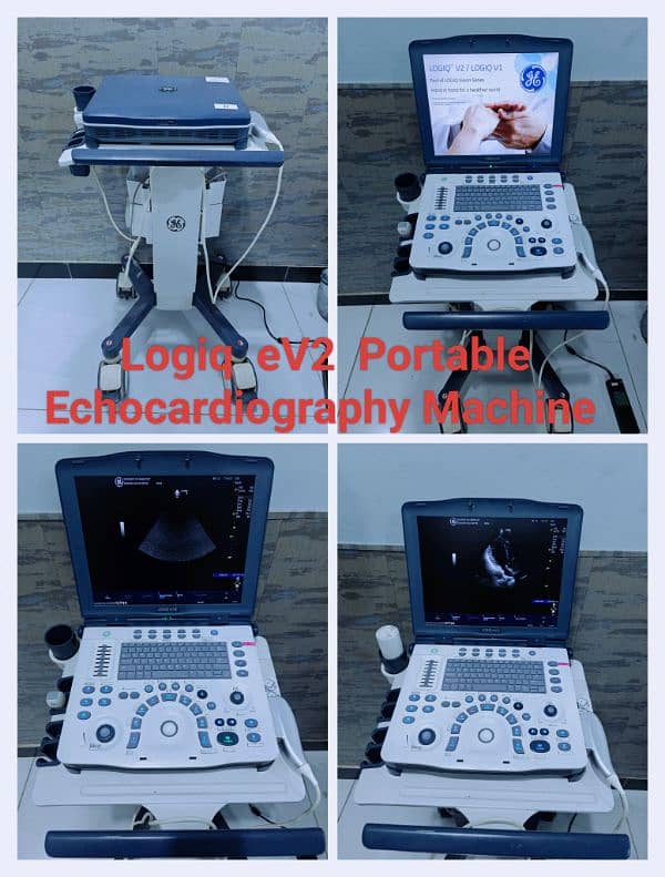 Ultrasound & Echocardiography Machines 4