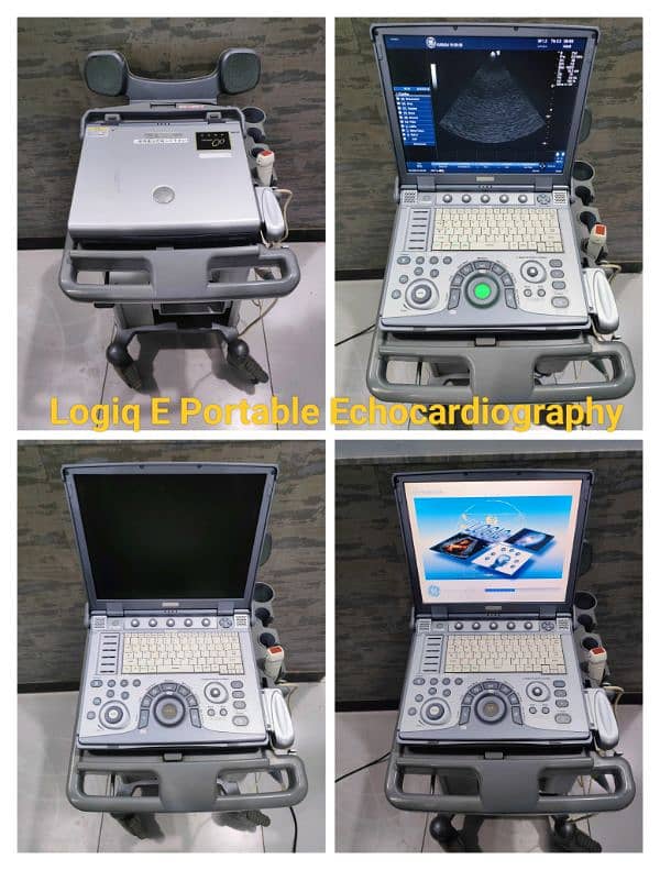 Ultrasound & Echocardiography Machines 5