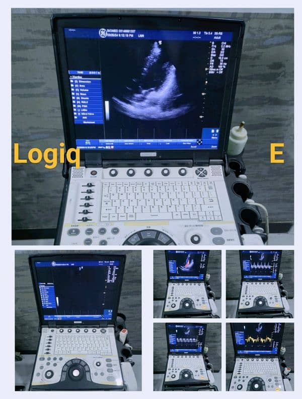 Ultrasound & Echocardiography Machines 7