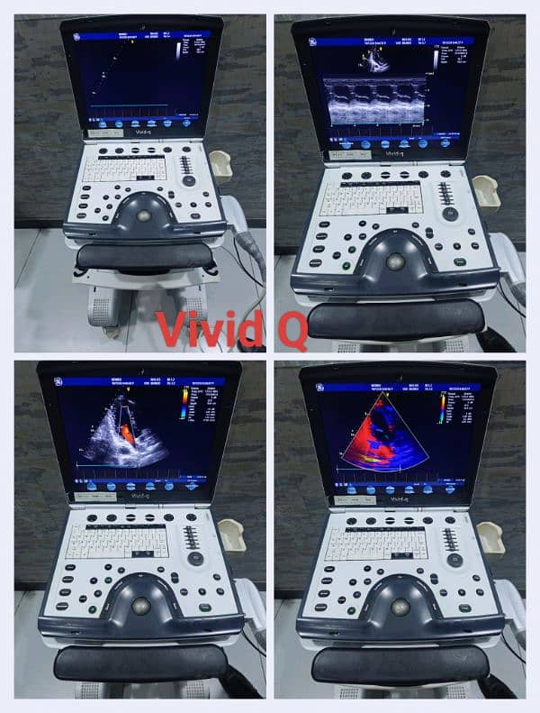 Ultrasound & Echocardiography Machines 8