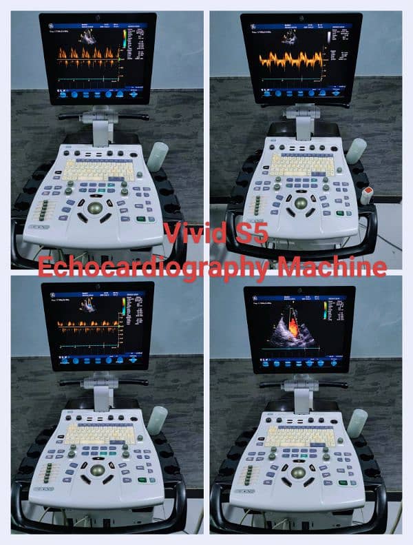 Ultrasound & Echocardiography Machines 12