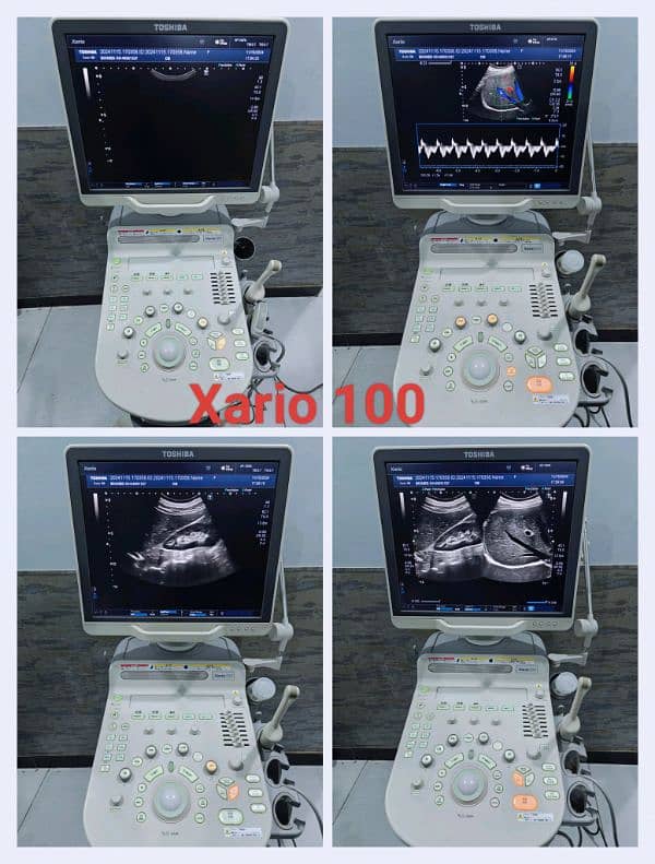 All types of Ultrasound Machines 13