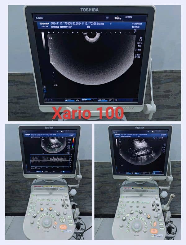 All types of Ultrasound Machines 14