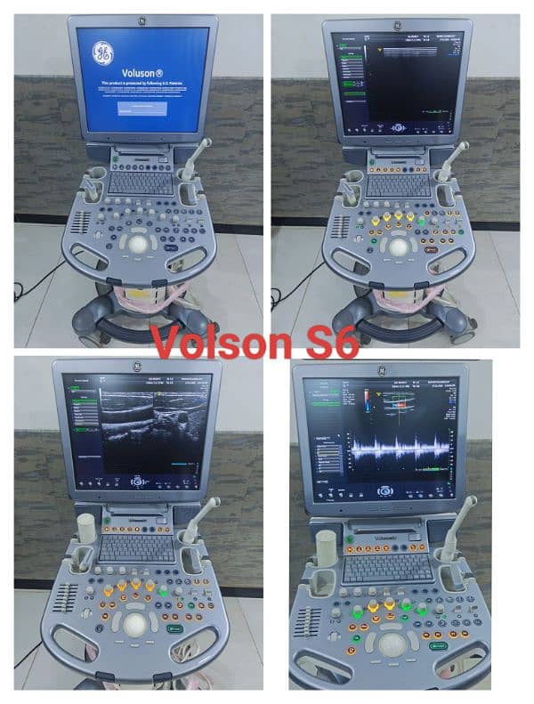 All types of Ultrasound Machines 15