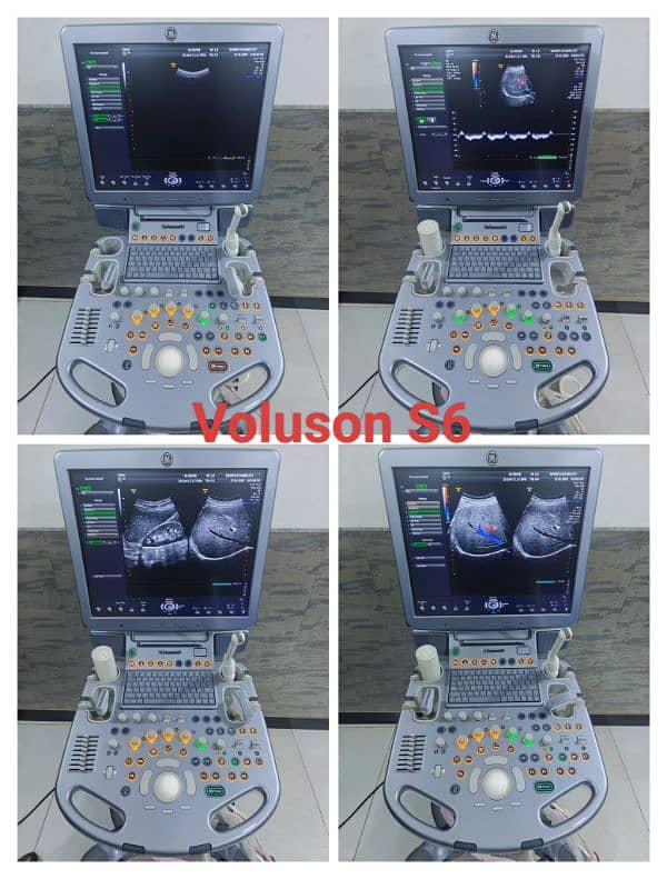 All types of Ultrasound Machines 16