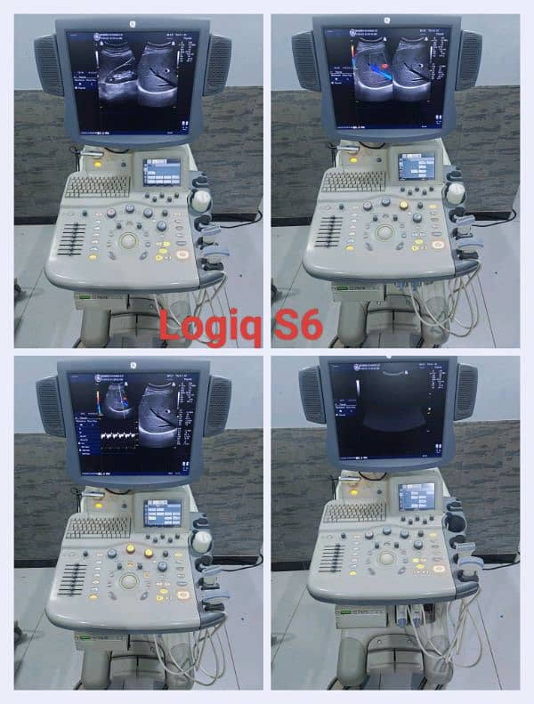 All types of Ultrasound Machines 18