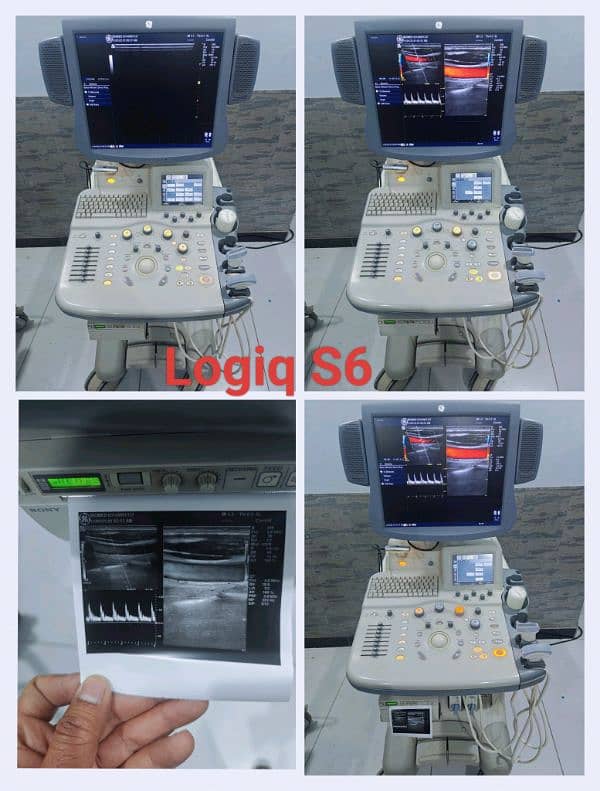 All types of Ultrasound Machines 19