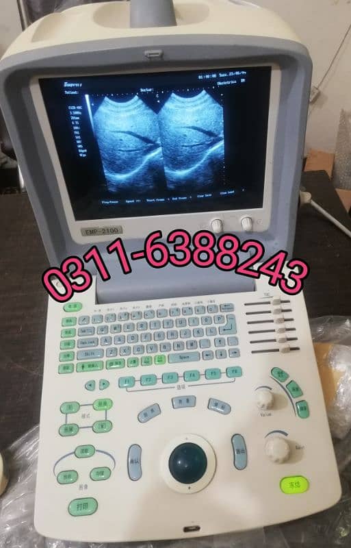 Branded Japanese & China Ultrasound machine's 4