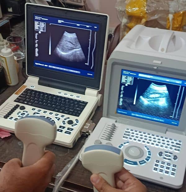 Branded Japanese & China Ultrasound machine's 14