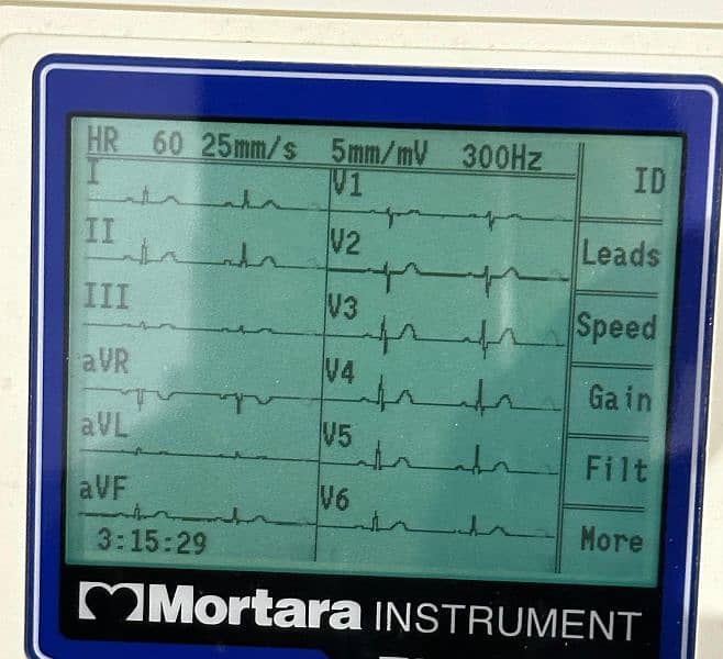 Mortara ECG machine 3