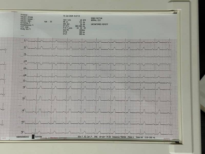 Mortara ECG machine 6