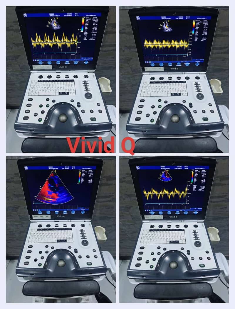 Ultrasounds Machines/ Echocradiography Machines/All Types Of Machines 9