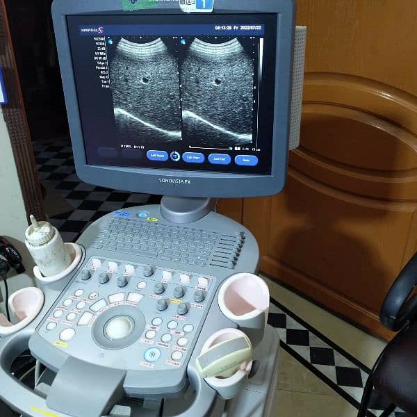 Sonovista fx colour doppler ultrasound machine 1