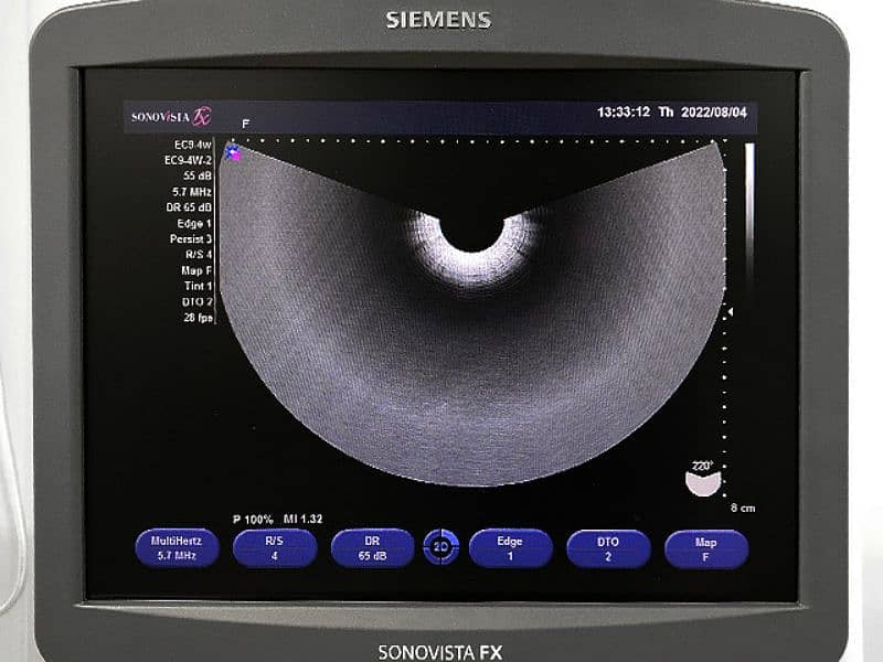 Sonovista fx colour doppler ultrasound machine 2