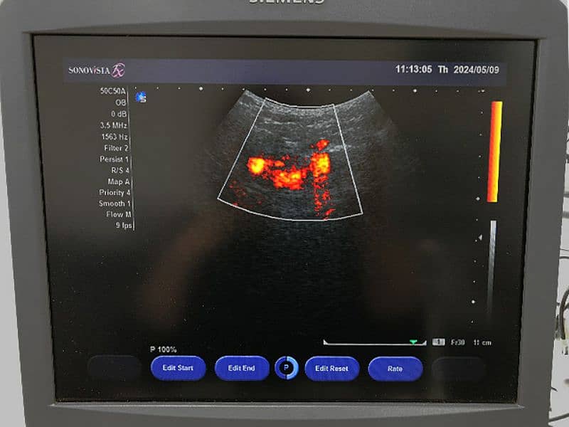 Sonovista fx colour doppler ultrasound machine 3