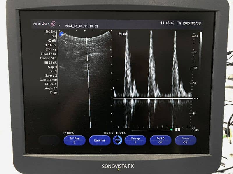 Sonovista fx colour doppler ultrasound machine 4