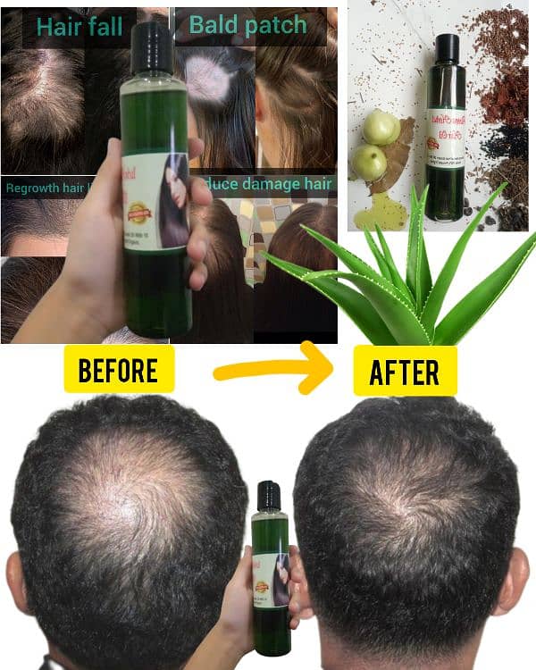 Alovera herbal hair growth oil 5