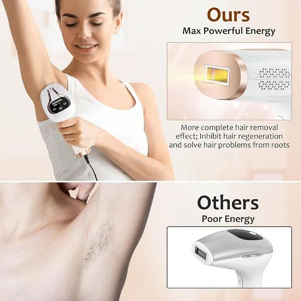 Original Laser Flash Painless Hair Removal For Face & Body 2