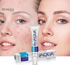 Acne scar removal cream | best acne remove cream