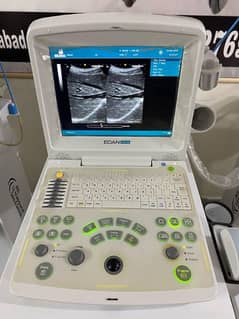 EDEN DUS 60 FOREIGN USED ULTRASOUND MACHINE