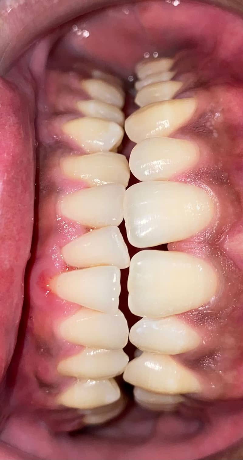 dental assisstant 0