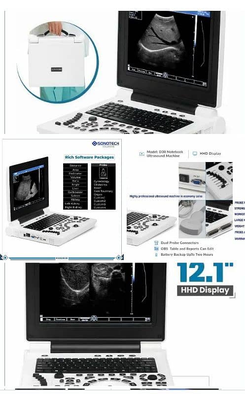 Orial note book!/VOLTA SONOBOOK  BATTERY OPRATED ULTRASOUND MACHINE 10