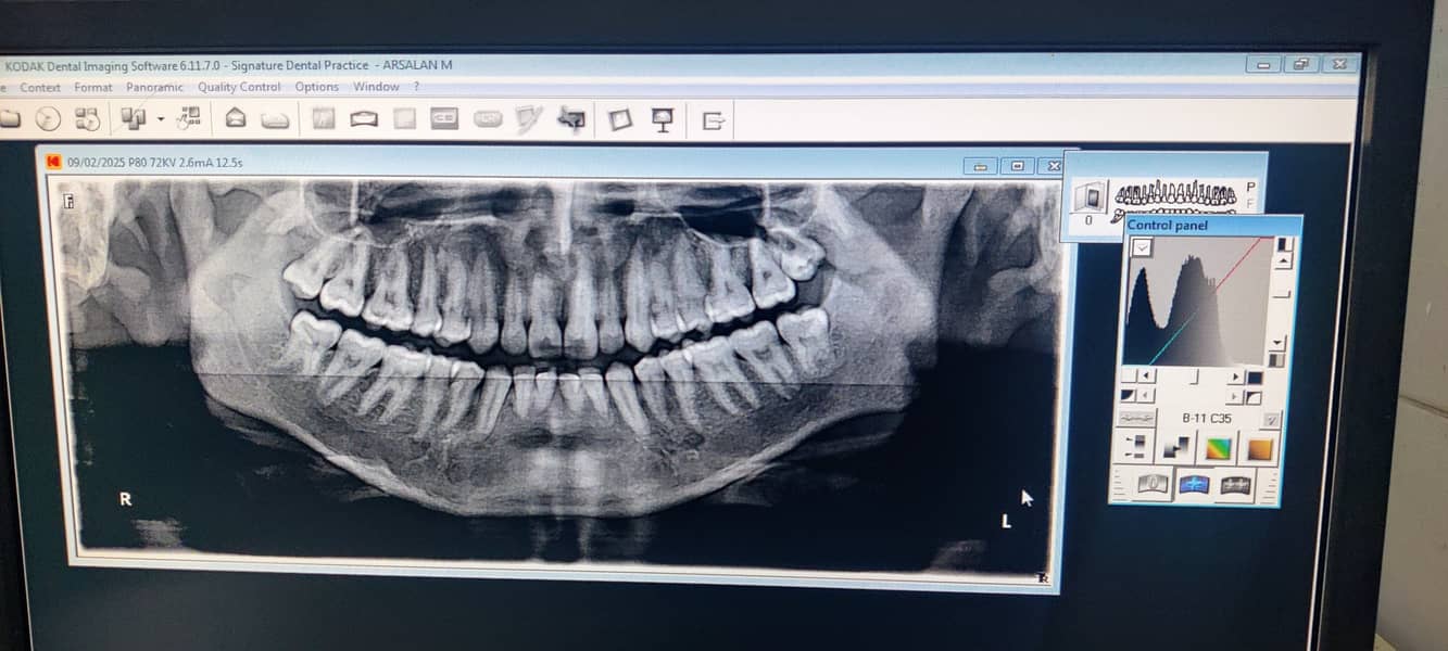 Yoshida Penora 19 OPG X-ray machine 4