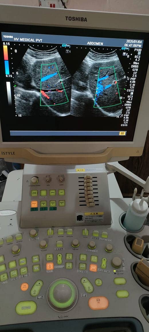 Refurb Japanese Ultrasound color Doppler in low price 3