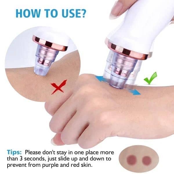 Vacuum Blackhead remover 4