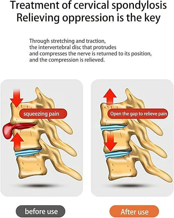 Over The Door Cervical Neck Traction Device Therapy, Neck strecher 2