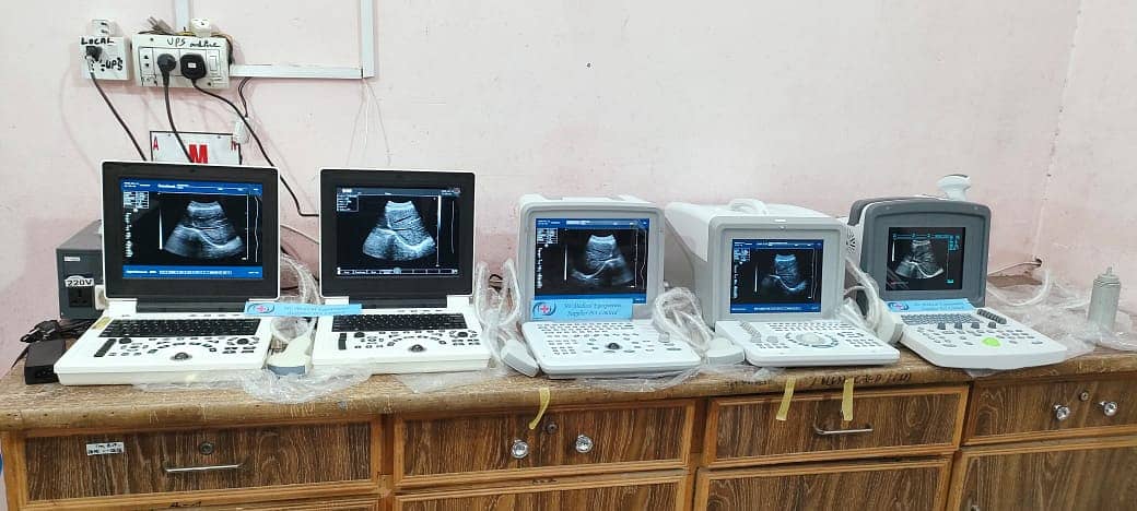 Used & New Chinese ultrasound machine (with or without battery backup 1