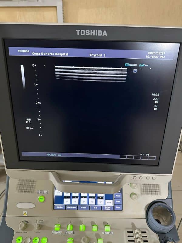 Ultrasound Machine Xario Prime 3