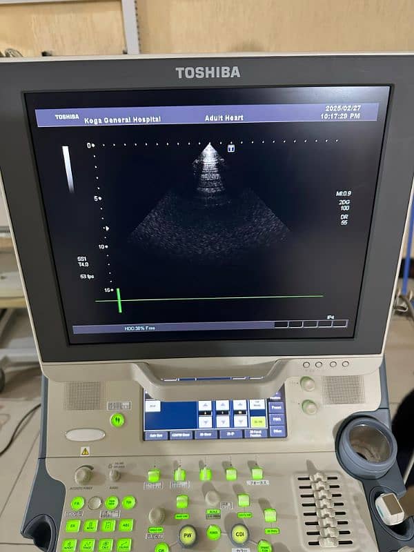 Ultrasound Machine Xario Prime 4