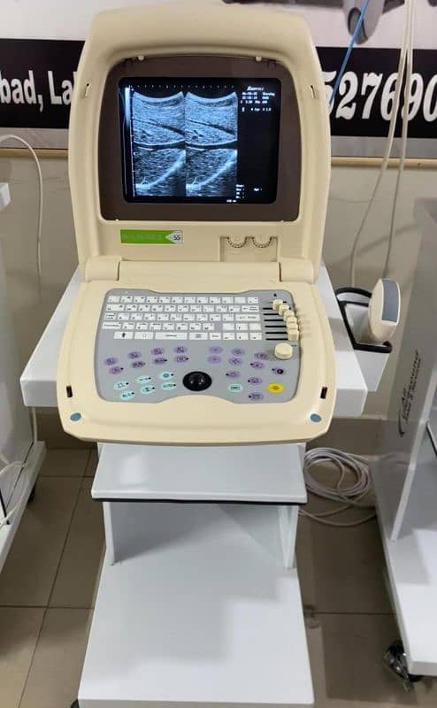 Ultrasound machine 2