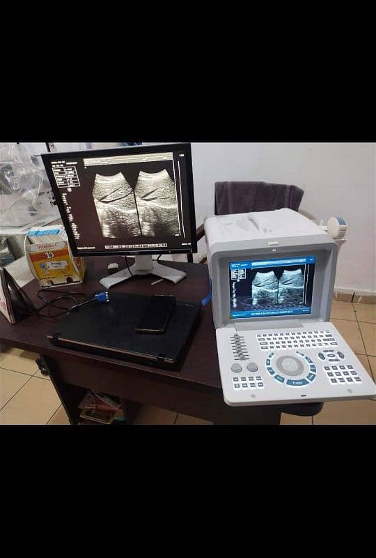 China & Japanese Ultrasound Machine's 2