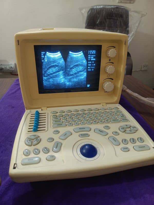 China & Japanese Ultrasound Machine's 16