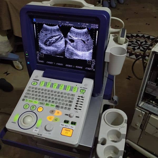 Ultrasound Machine's 9