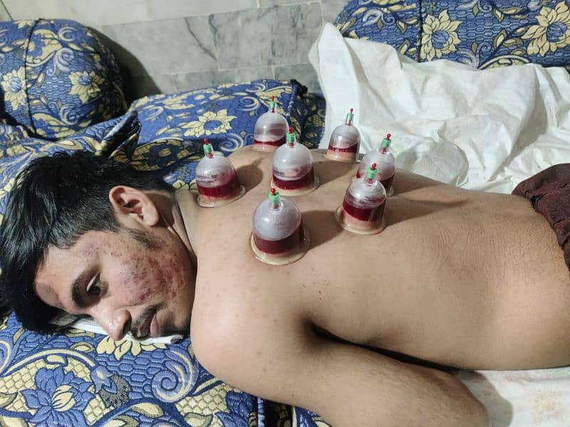 AlHijama center **RS 250 1