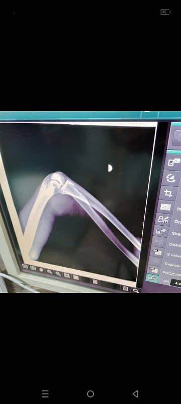 portable x-rays machine GE 03375100123 1