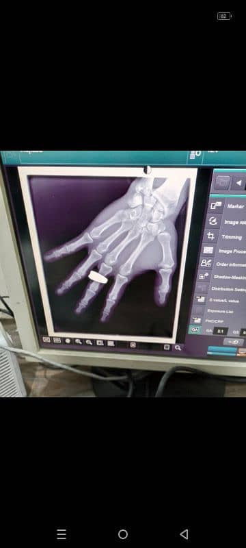 portable x-rays machine GE 03375100123 2